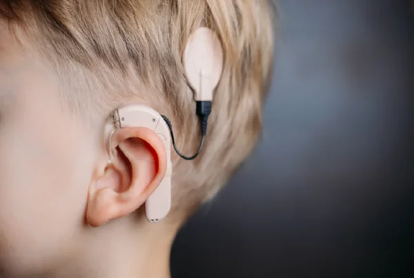 Cochlear Implants