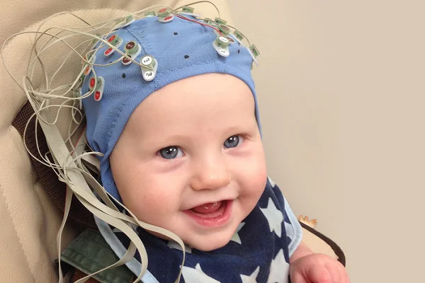 BERA